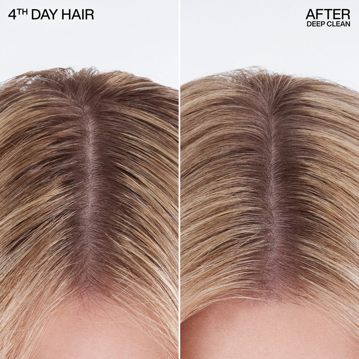 Deep Clean Dry Shampoo - US 0687
