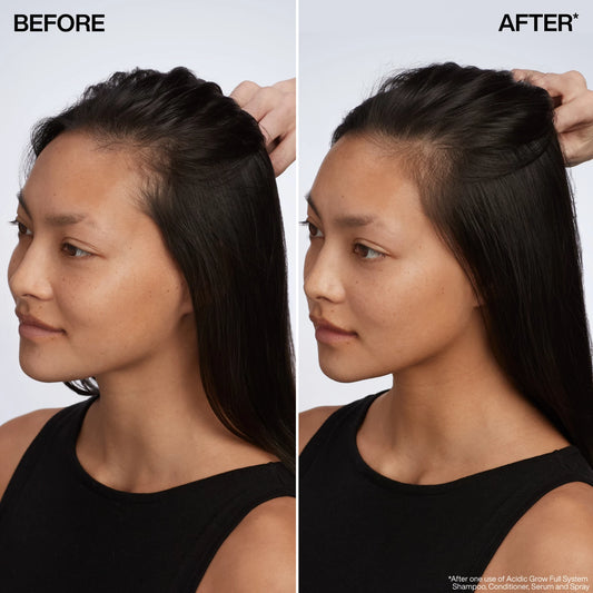 Acidic Grow Full System Scalp & Hair Serum - US 2182